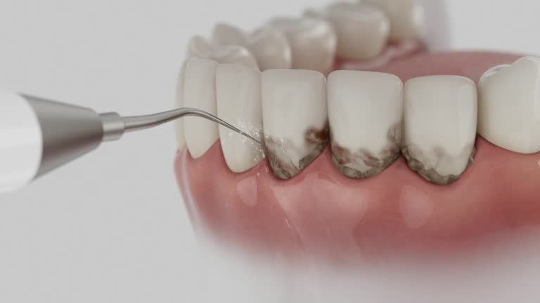 Trusted Teeth Cleaning And Checkup service in Jefferson, NC - Dentist Open Now
